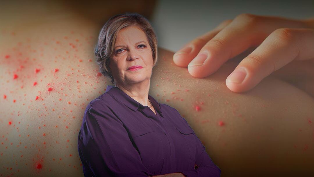 raqwuvvq45dahd53o7tfyfq2ee-1 Era un bebé de 14 meses: confirman primera muerte por sarampión en la CDMX