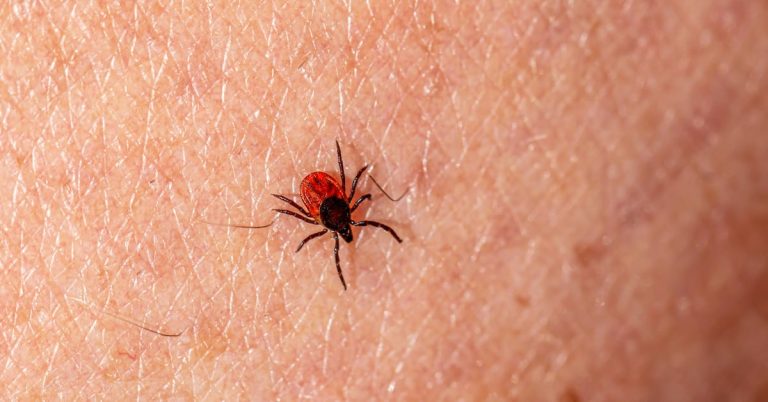 yy7hklqyerarvbd3v7i2sapd4q